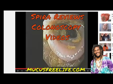 Cure Colitis With Constipation Naturally Guaranteed Cure Colitis With Constipation Naturally Guaranteed