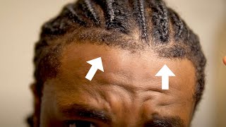 How To Get The Perfect Front Taper Hairline, Side Taper & Back Taper | Braids, Dreads, Twist & Afro