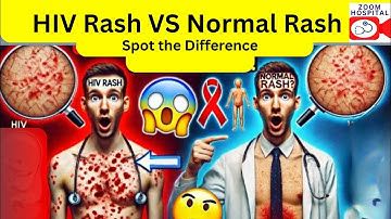 HIV Rash vs. Normal Rash: How to Tell the Difference