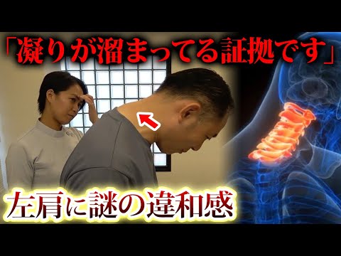 千葉県八千代市でストレートネック・スマホ首の改善 | 【千葉県