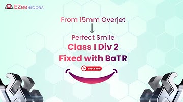 Beyond Straight Teeth ✨ Sculpting Faces with Biophilic Orthodontics, BaTR & BRAVE Appliance