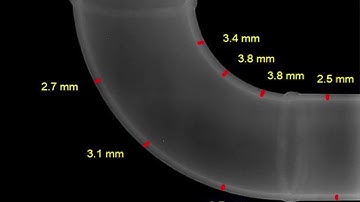#profile #radiography