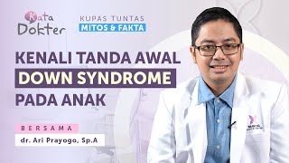 Kata Dokter Kenali Apa Itu Down Syndrome