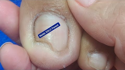 Pedicure This one #satisfying