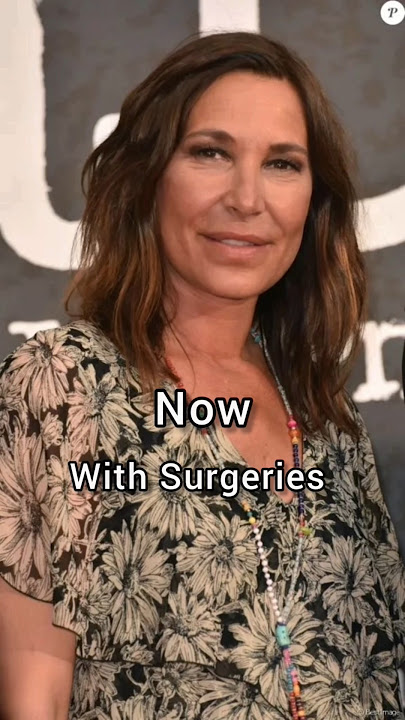 zazie before Vs after Surgeries[Requested] #zazie #celebritygossip #celebritynews #music