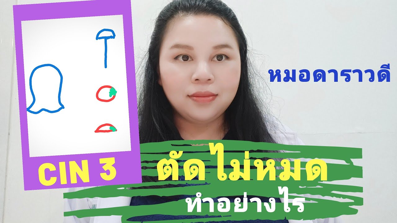 cin คือ Update 2022 CIN3 รอยโรคก่อนมะเร็งปากมดลูก ตัดออกไม่หมด ต้องทำอย่างไร by หมอดาราวดี