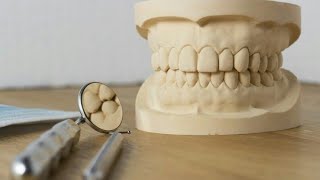 طب الأسنان  طريقة صب الطبعات