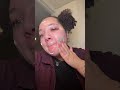 #acne #skincare #skincareroutine #tretinoin