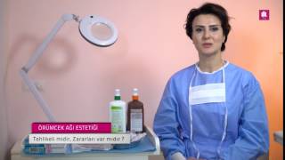 Örümcek Ağı Estetiği Tehlikeli Midir, Zararları Var Mıdır?