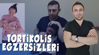 Sol Tortikolisli Bebek Esnemeler | Bebekler için Tortikolis Ev Egzersizleri👶