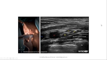 lecture presentation : ultrasound guided costoclavicular block