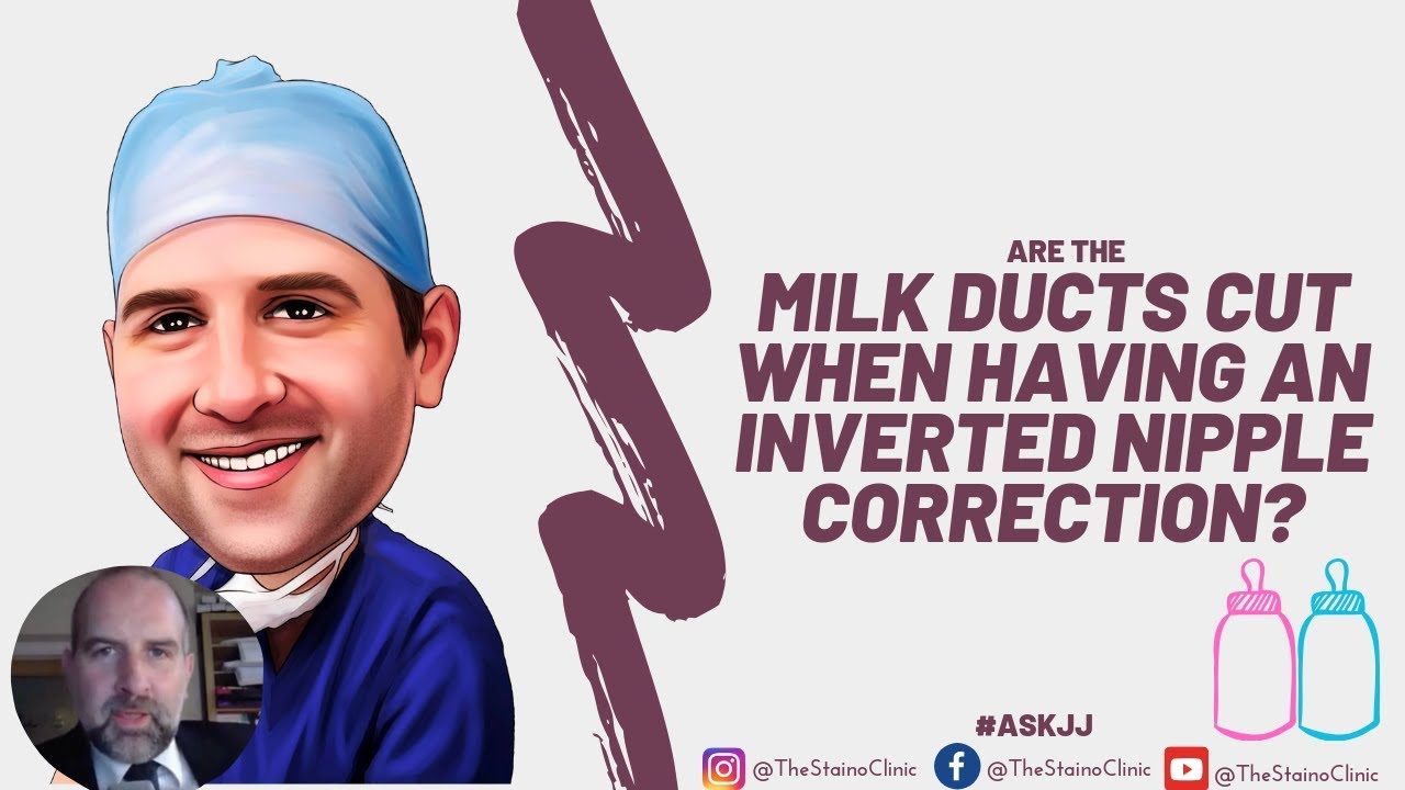 Are the milk ducts cut after having an inverted nipple correction