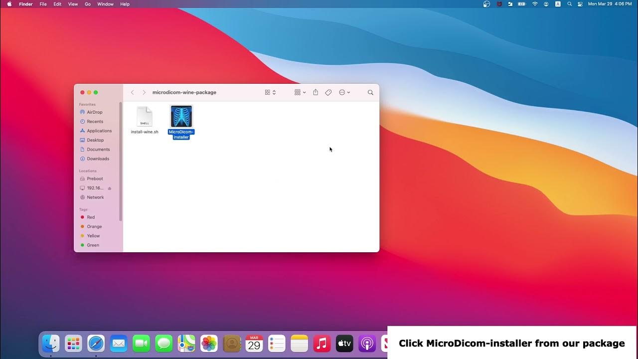 Microdicom viewer