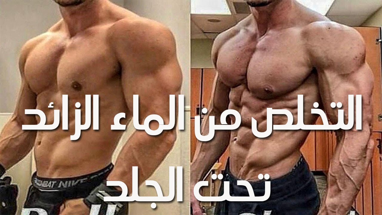 التخلص من الماء الزائد تحت الجلد