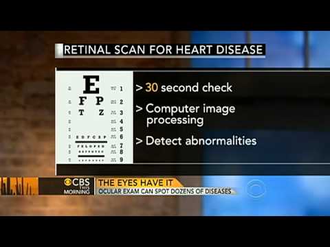 Eyes as window on your health