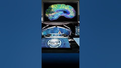 #Neurons #Stimulation #Brain #Research #micro #Devices #Electrode #Ultraflexible #efficacy #Efficacy