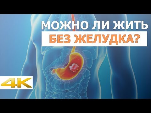 Можно ли жить без желудка?