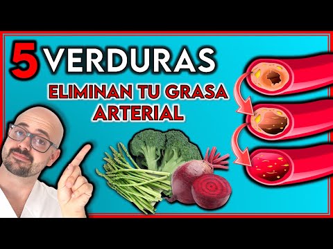 Alimentos buenos para tus venas y arterias