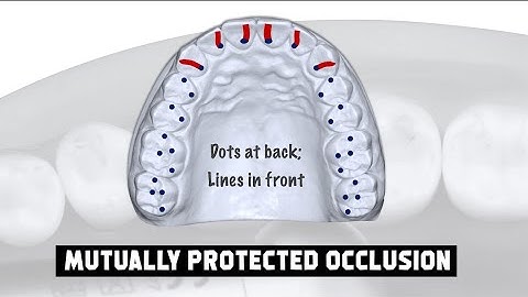 Dental Occlusion: Plan Optimal vs Plan Minimal- A new perspective