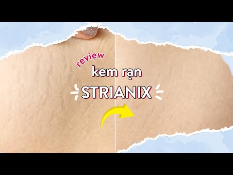 Review Kem Rạn Strianix ♡ Quin