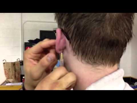 Vidéo: 3 façons de drainer l'oreille de chou-fleur