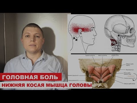 Видео: Превъзходна анатомия, функция и диаграма на Obliquus Capitis - Карти на тялото