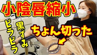 【小陰唇縮小】女性器のビラビラ・黒ずみを切って人生確変【モティーフ銀座クリニック】