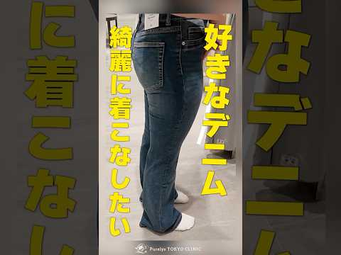 デニムを綺麗に着こなしたい！太もも脂肪吸引に密着！