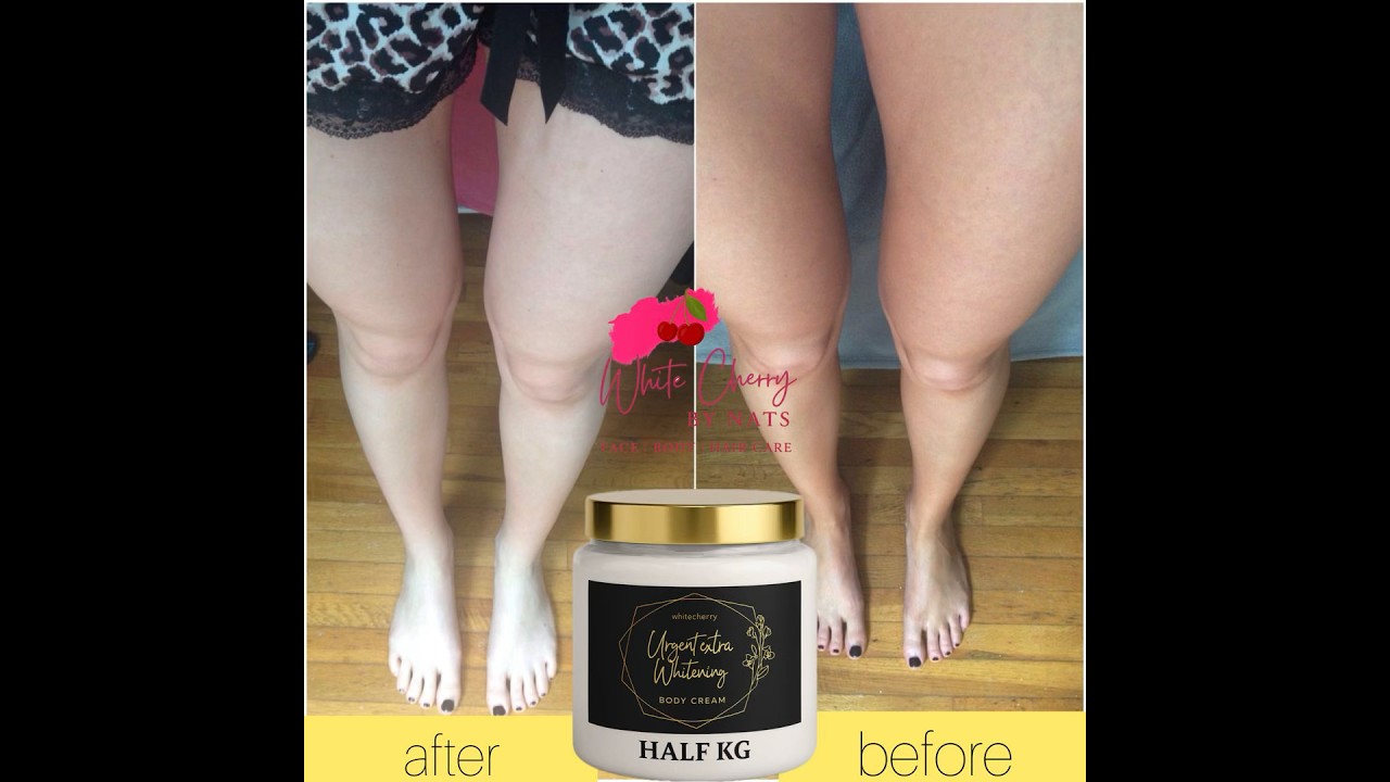 “Unbelievable Skin Whitening Results 😍 | Real Before After | WhiteCherry Cream Review” 