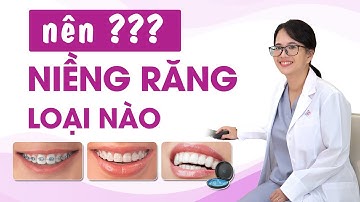 Nên niềng răng loại nào? Ưu nhược điểm các loại niềng răng - Các loại niềng răng và chi phí