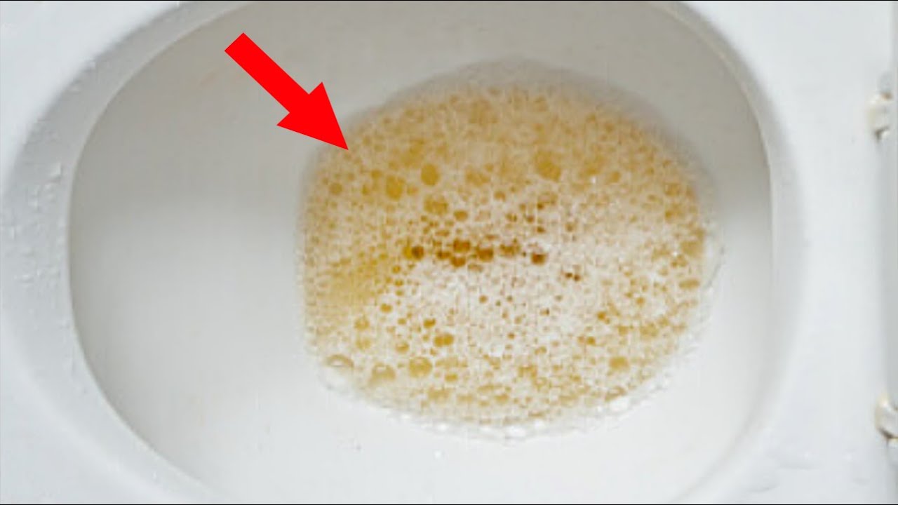 透明な尿の原因は何ですか?