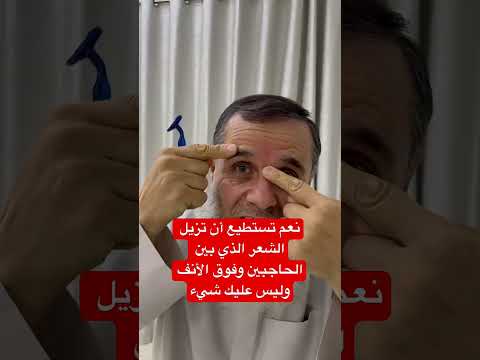 إزالة الشعر الذي فوقه الأنف وبين الحاجبين هذا ليس من الحاجبين وليس عليك شي إذا حلقته