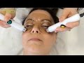 CACI Eye Revive Step by Step Video