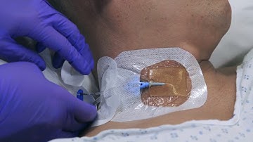 PICC CVC Device 1877-2100 For CVC Application Video