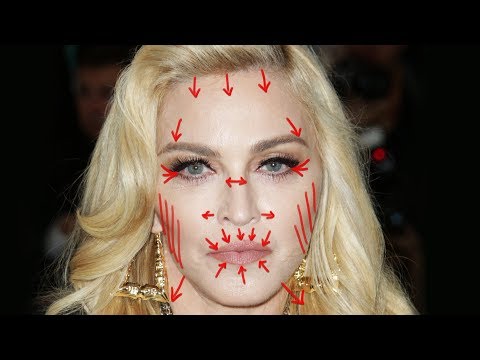 Removing MADONNA'S Plastic Surgery