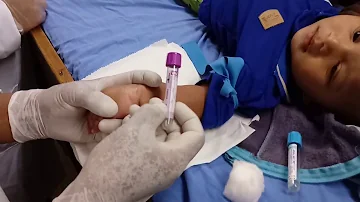 Como é feito a coleta de sangue em bebê?