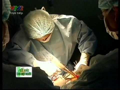 Truyền hình trực tiếp thay khớp háng nhân tạo toàn phần.mpg