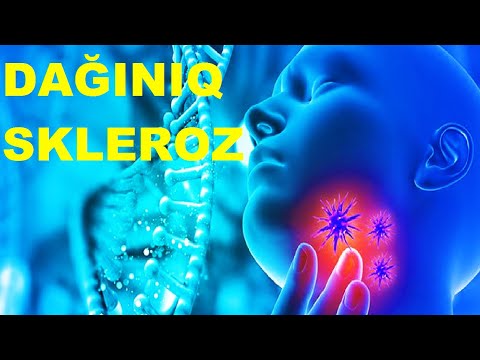 Video: Dağınıq skleroz sizi öldürürmü?