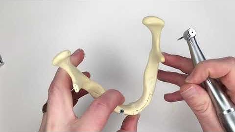 Hero Implants - Ridge Split Techniques