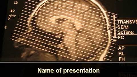 Brain Tomography Slice PowerPoint Template by PoweredTemplate.com