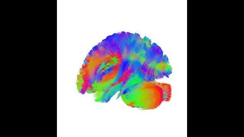 Human brain tractography