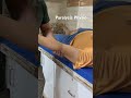 Upper limb nerve weak treatment# paralysis muscle stimulation by simple technique of Physio#limb pt#