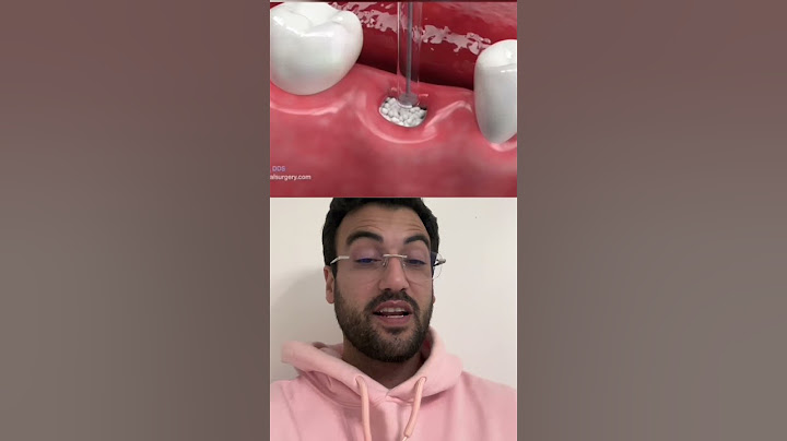 COMO É A EXTRAÇÃO DE UM DENTE?