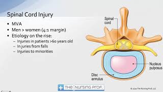 CCRN Neurological 1