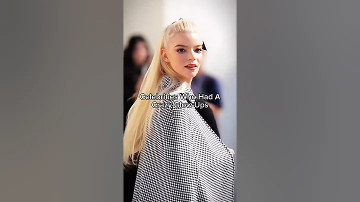 They literally had the craziest glow ups ever 😍😱