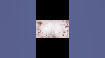 Me every time I get flashed! #mw2 #callofduty #flash