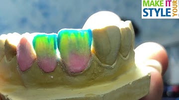 IPS STYLE... ESTRATIFICACION METAL CERAMICA