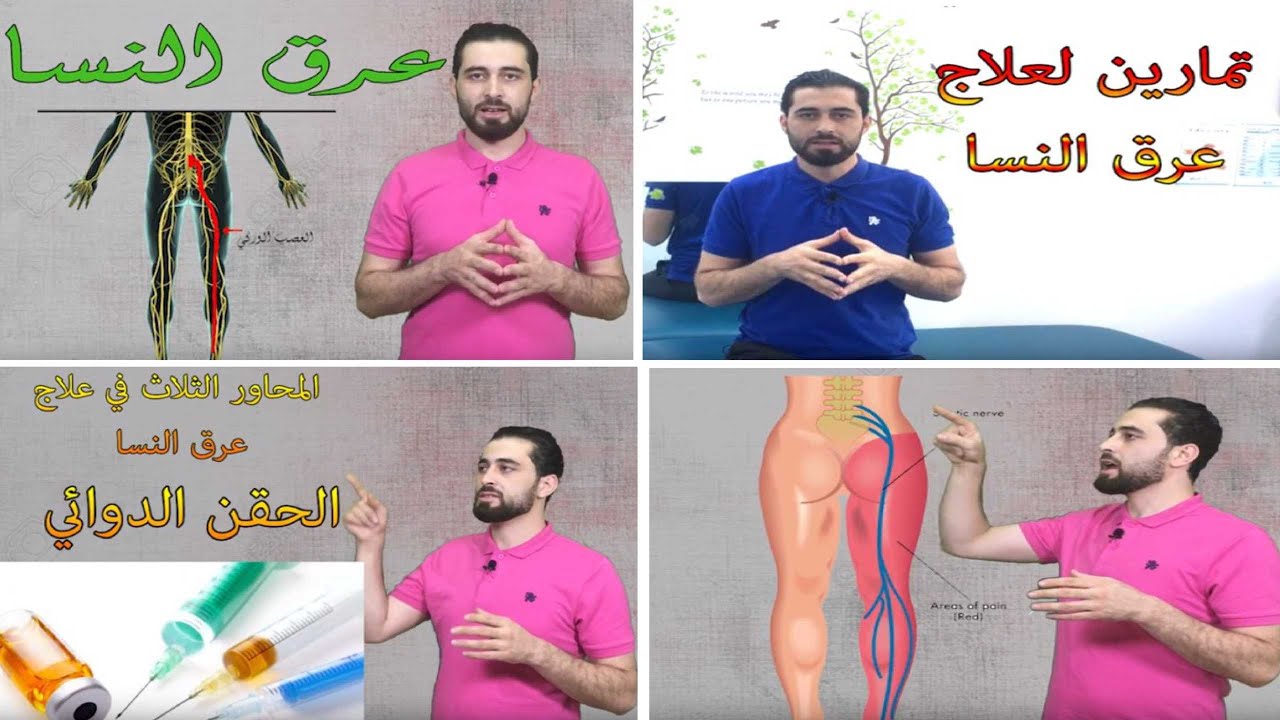 عرق النسا  ما هي الأسباب والأعراض والعلاجات المناسبة و طرق الوقاية؟؟