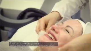 Laser Skin Rejuvenation with Cynosure’s Multiplex Affirm System  at The Laser and Skin Clinic