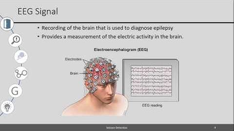 Biomedical Signal Processing: Seizure Detection [InnovativeFPGA]